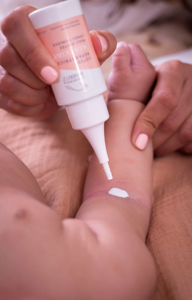 applying Organic Reparative Lotion on baby's arm